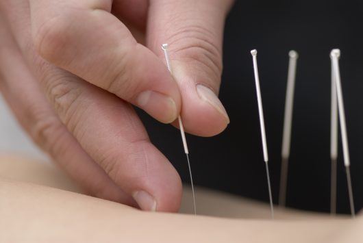 Reproductive health disorders: The treatment of male sexual dysfunction using acupuncture therapy