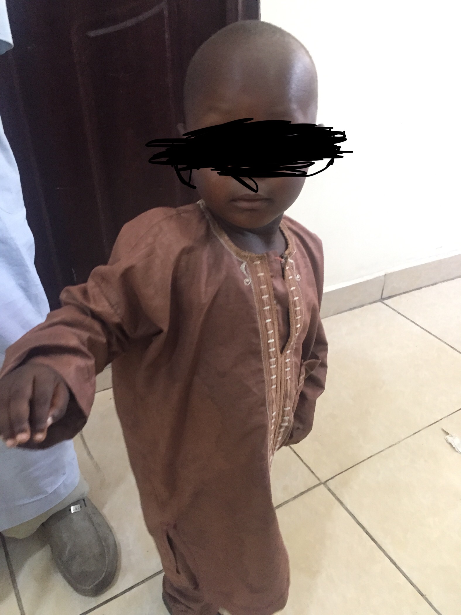 Malnutrition: How RUTF saved 3 year old Borno community boy from dying